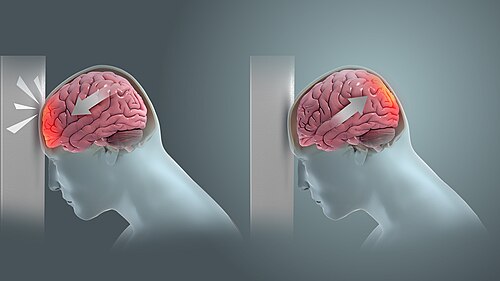 Traumatic Brain Inj Traumatic Brain Injury - Oak Tree Behavioral